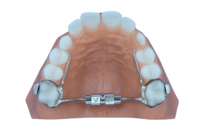 Mini Palatal Expander-sml