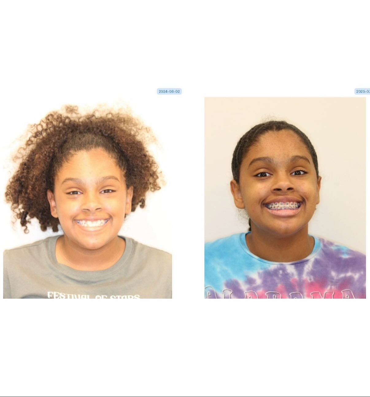 b:a case 4 second pic